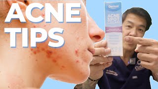 How to treat Acne at Home | Dr Davin Lim