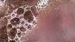 ALICAM Normal small intestine