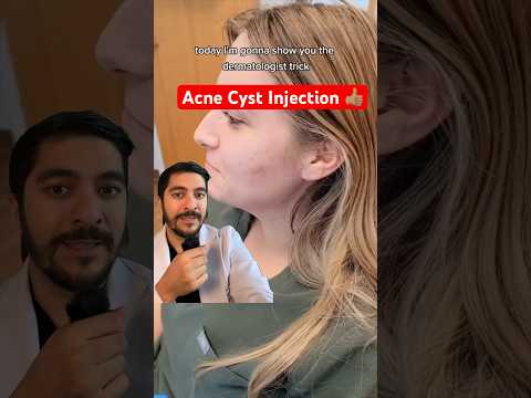Fastest Way To Treat Acne Cyst