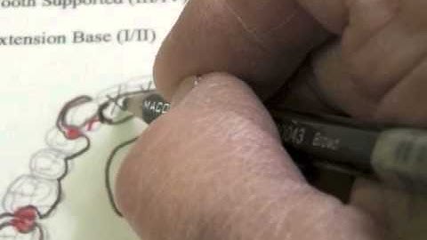 R P D Design - Ken Class IV Max Cast #2 Dot Part C