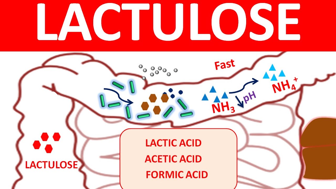 Lactulose for chronic constipation and hepatic encephalopathy
