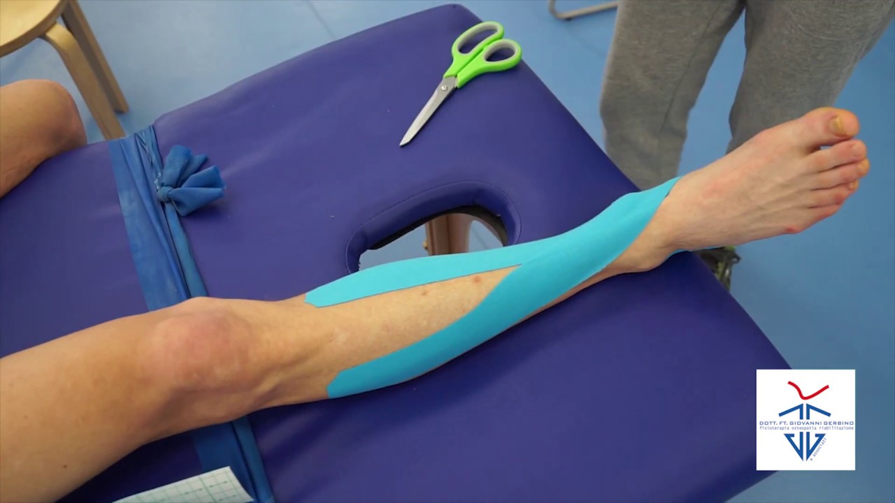 Applicazione di Kinesio Tape YouTube