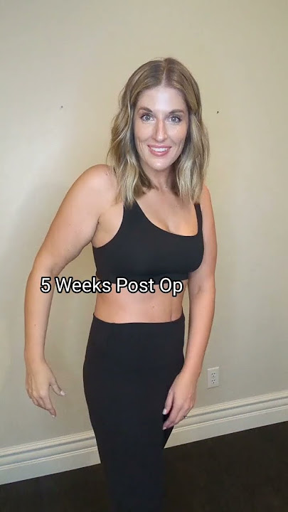 Skin Removal After 100  Pound Weight Loss