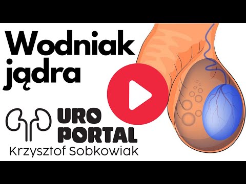 Wideo: 3 sposoby, aby dowiedzieć się, czy masz wodniaka