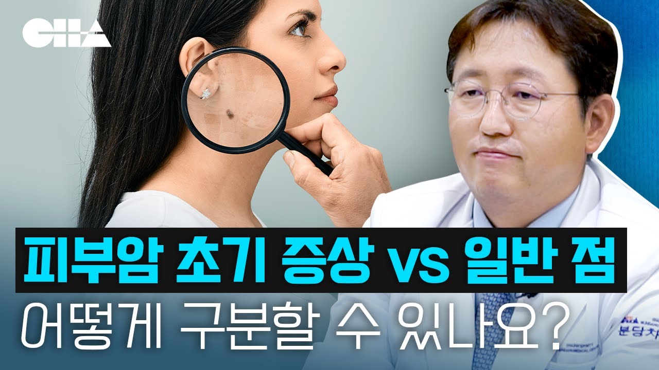 피부암 초기 증상 vs 일반 점, 어떻게 구분하나요? 피부암 진단 및 치료법 - YouTube