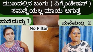 Home remedy for pigmentation | best home remedy for dark spots | Skincare | home remedy