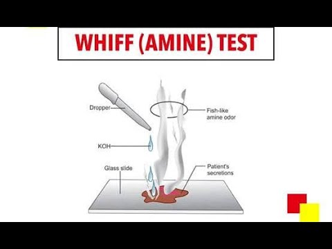 Potassium hydroxide KOH Test for Bacteria Vaginosis - Whiff Test - YouTube