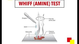 Potassium hydroxide KOH Test for Bacteria Vaginosis - Whiff Test
