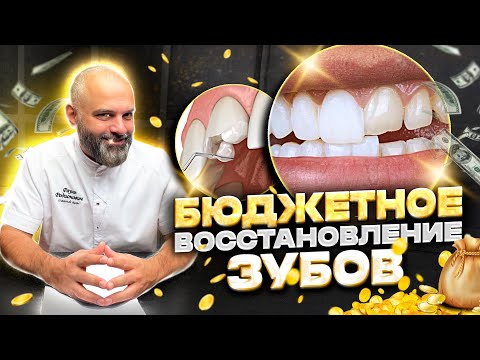 Как восстановить зубы недорого! Бюджетное Восстановление потерянных зубов. Утратил зуб, что делать?