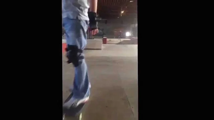 Skateboard Mishap