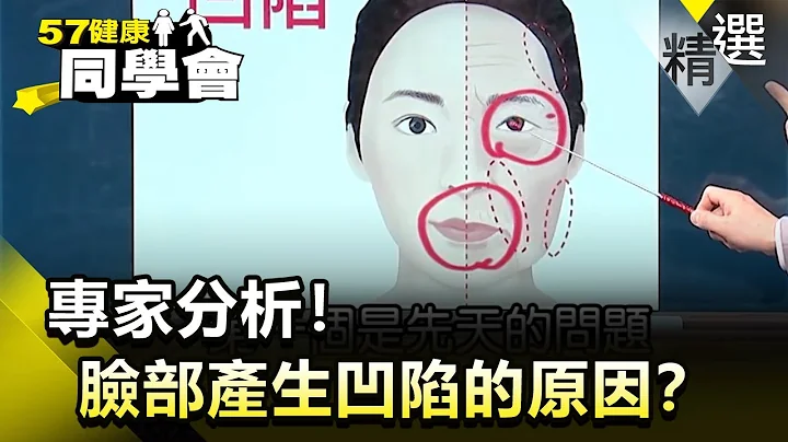 专家分析！脸部产生凹陷的原因？【健康同学会】精华篇｜隋安德 许晶晶 - 天天要闻