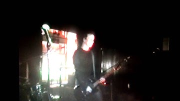 VICTIMS OF PROGRESS -SINGER LIGHTS LEG ON FIRE!