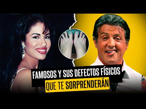 Video: Defectos encantadores: 5 celebridades con defectos físicos