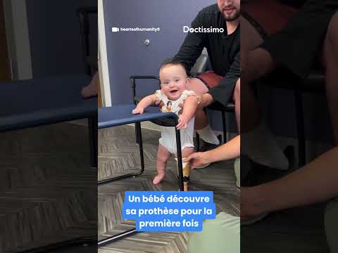 Les premiers pas d’un bébé avec sa prothèse 🥹​✨​