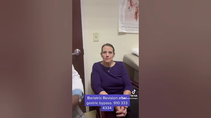 Bariatric Revision after gastric bypass surgery! Non surgical, endoscopic solution #TORe