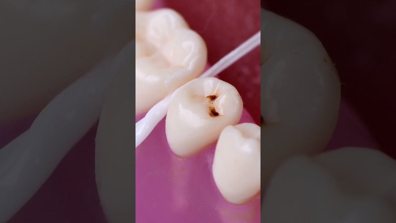 Temporary Cavity Relief Hack Shorts