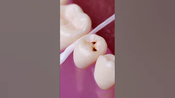 Temporary Cavity Relief Hack Shorts 