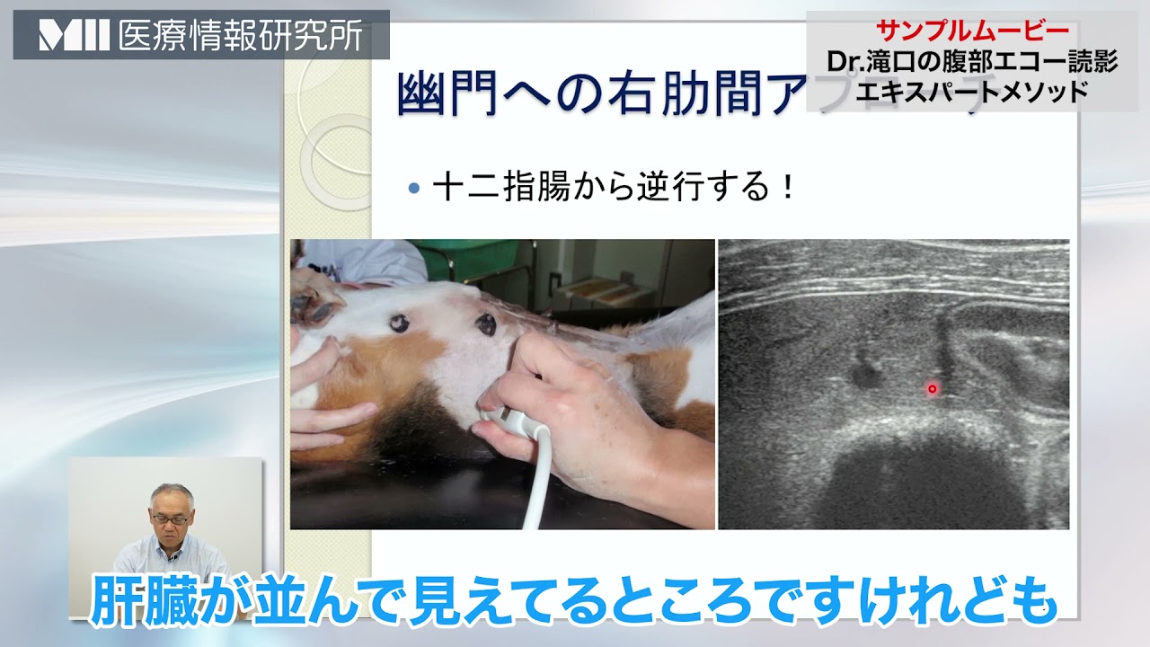 DVD Dr.滝口の腹部エコー読影 エキスパートメソッド hq720.jpg?sqp=-