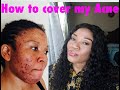 How to cover acne spots with simple makeup