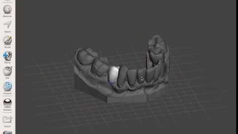 Adding Tooth Libraries in Meshmixer