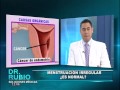 MENSTRUACION IRREGULAR, ES NORMAL?