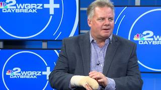 Patrick Hammer explains what happened to his hand