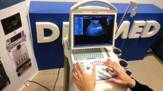 Turorial Mindray DP-10