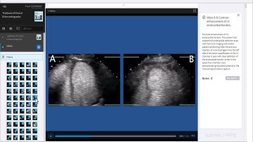 Elsevier Expert Consult Demo Video