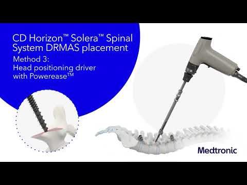CD Horizon™ Solera™ Spinal System + Dual Rod Multi-Axial Screw (DRMAS) & Variable Angle Domino (VAD)