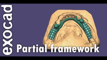 First partial framework in partialcad