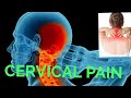 Cervical pain exerciseneck pain  exercisepainhealeravijit8316cervical pain