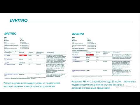 Индекс здоровья простаты - многофакторная оценка риска рака предстательной железы