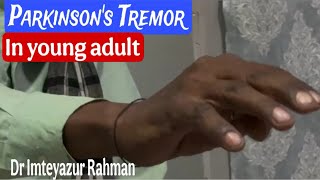 Parkinson’s tremor in young Adult