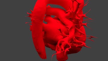 VASST Lab: Cardiac Segmentation