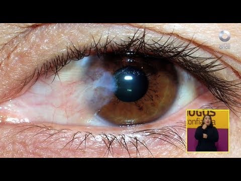 Diálogos en confianza (Salud) - Glaucoma y sus tratamientos (15/01/2018)