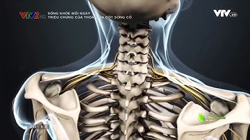 [CVG.3] Cấu tạo đốt sống cổ