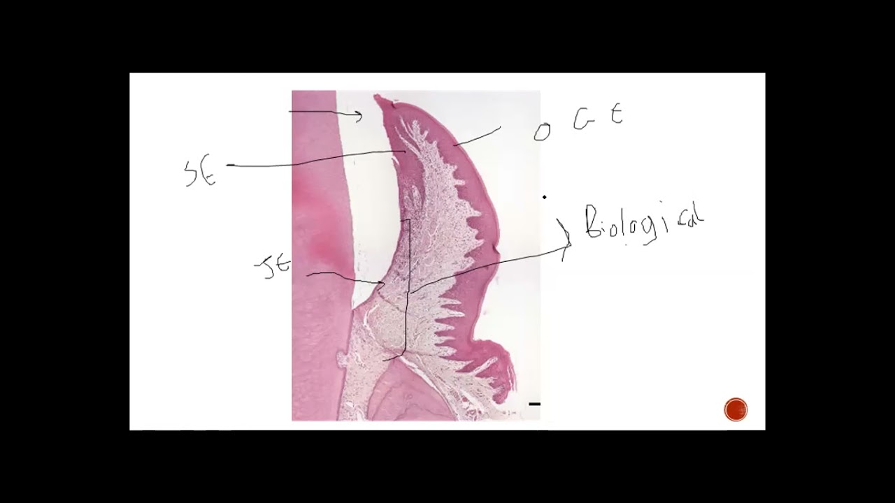 oral mucosa revesion