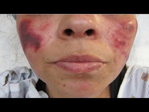 ЧТО БУДЕТ ЕСЛИ В ОРГАНИЗМ ПОПАДЕТ ЯД ФУГУ??