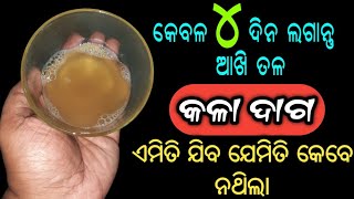 କେବଳ ୪ ଦିନ ଲଗାନ୍ତୁ,ଆଖି ତଳ କଳା ଦାଗ ଗାୟବ ହୋଇଯିବ | How to Remove Dark Circles Naturally in 4 Days[100%]