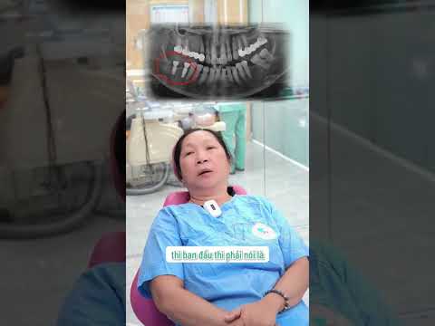 Review khách hàng về nha khoa Asia | cảm nhận sau khi làm răng | cấy ghép implant nhổ và ghép xương