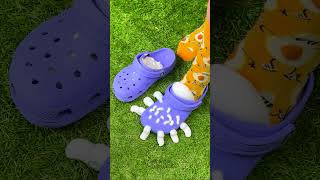 Thumbnail for PILIHLAH PASANGAN KAUS KAKI 🧦 MEMBERSIHKAN KAKI