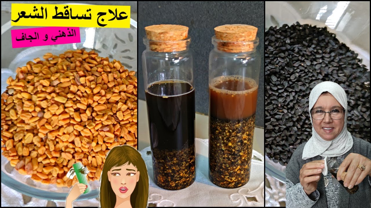 علاج تساقط الشعر بعد الولادة و علاج فروة الراس للشعر الذهني و الجاف مع الحاجة فاطمة