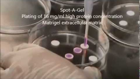 Spot an extracellular matrix barrier - SeedEZ Video Tutorial