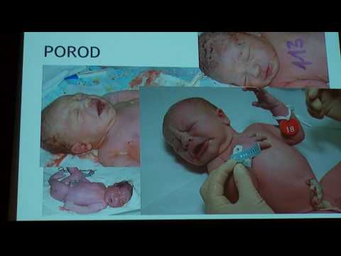 Video: Život Po Porodu: Krmení Novorozence, Duševní Zdraví A Další