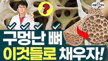 숭숭 구멍난 뼈! 먹으면서 채워주세요. 골다공증을 위한 영양소!