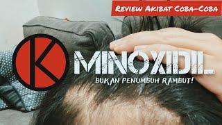 Minoxidil Efek Samping Untuk Rambut ‼️ #minoxidil #rambutrontok