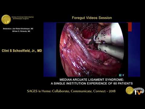 Videó: Median Arcuate Ligament Szindróma (MALS)