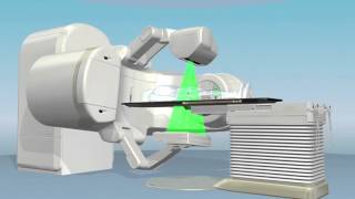 Prostate Cancer Treatment - IGRT Explained - At Spokane Cyberknife