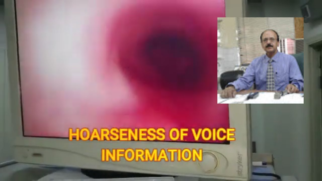 How To CURE A Hoarse Voice In An Hour Hoarseness of Throat
