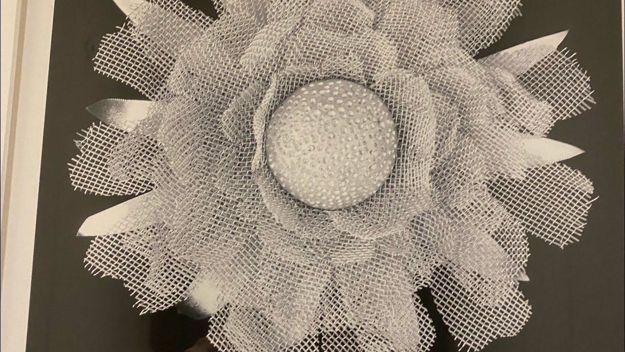 علاقه الغده الدرقية والصرع #د_أسامه_أبوالخير